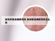 郑州市银消病研究所 郑州银消病研究所怎么样