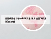 银屑病黑色印子十年不消退 银屑病留下的黑斑怎么去除