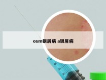 osm银屑病 a银屑病