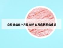 白殿疯病几个月能治好 白殿疯初期病症状