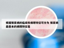 根据银屑病的临床和病理特征可分为 银屑病最基本的病理特征是