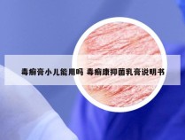 毒癣膏小儿能用吗 毒癣康抑菌乳膏说明书