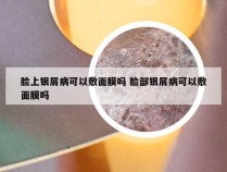 脸上银屑病可以敷面膜吗 脸部银屑病可以敷面膜吗