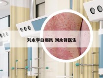 刘永学白癜风 刘永锋医生