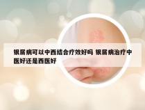 银屑病可以中西结合疗效好吗 银屑病治疗中医好还是西医好