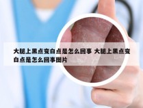 大腿上黑点变白点是怎么回事 大腿上黑点变白点是怎么回事图片