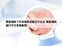 银屑病除了打生物挤还能打什么针 银屑病到底打不打生物制剂