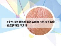 4岁小孩老是长癣是怎么回事 4岁孩子长癣的症状和治疗方法