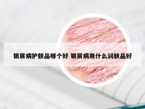 银屑病护肤品哪个好 银屑病用什么润肤品好