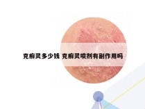 克癣灵多少钱 克癣灵喷剂有副作用吗