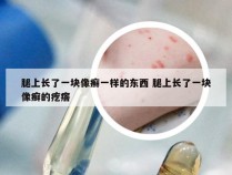 腿上长了一块像癣一样的东西 腿上长了一块像癣的疙瘩