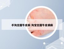 手淘主图牛皮癣 淘宝主图牛皮病癣