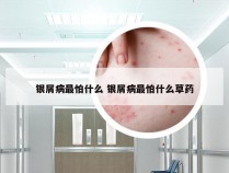 银屑病最怕什么 银屑病最怕什么草药