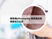 银屑病pifusaoyang 银屑病皮肤瘙痒吃什么药