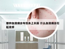 那种血液病会导致身上长藓 什么血液病会引起皮疹