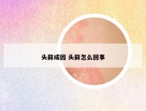 头藓成因 头藓怎么回事