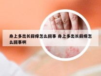 身上多出长藓痒怎么回事 身上多出长藓痒怎么回事啊