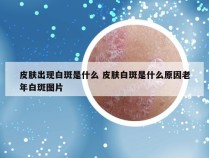 皮肤出现白斑是什么 皮肤白斑是什么原因老年白斑图片