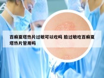 百癣夏塔热片过敏可以吃吗 脸过敏吃百癣夏塔热片管用吗