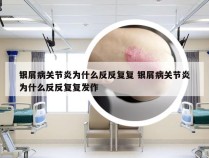 银屑病关节炎为什么反反复复 银屑病关节炎为什么反反复复发作