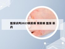 医保谈判2023银屑病 银屑病 医保 新药