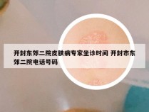 开封东郊二院皮肤病专家坐诊时间 开封市东郊二院电话号码