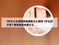 5岁半小女孩得银削病是什么原因 5岁女孩子得了银屑病意味着什么