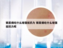 银屑病吃什么增强抵抗力 银屑病吃什么增强抵抗力呢