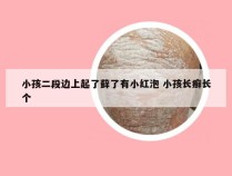 小孩二段边上起了藓了有小红泡 小孩长癣长个