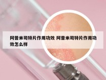 阿普米司特片作用功效 阿普米司特片作用功效怎么样