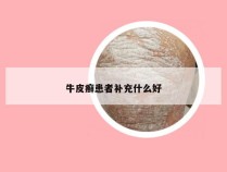 牛皮癣患者补充什么好