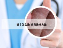 银痟怎么治 银肖治疗方法