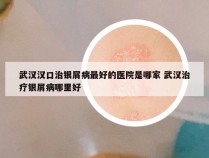 武汉汉口治银屑病最好的医院是哪家 武汉治疗银屑病哪里好