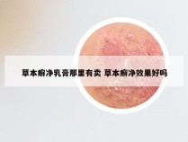 草本癣净乳膏那里有卖 草本癣净效果好吗