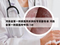 河南省第一附属医院皮肤科专家都有谁 河南省第一附属医院专家门诊