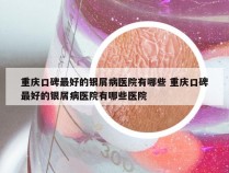 重庆口碑最好的银屑病医院有哪些 重庆口碑最好的银屑病医院有哪些医院