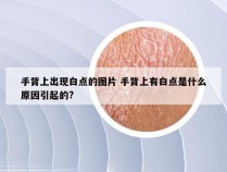 手背上出现白点的图片 手背上有白点是什么原因引起的?