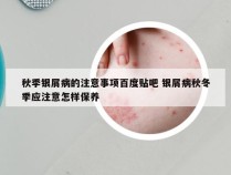 秋季银屑病的注意事项百度贴吧 银屑病秋冬季应注意怎样保养