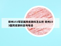 郑州153军区医院皮肤科怎么样 郑州153医院皮肤科咨询电话