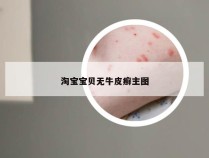 淘宝宝贝无牛皮癣主图