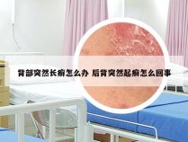 背部突然长癣怎么办 后背突然起癣怎么回事