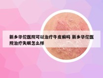 新乡华佗医院可以治疗牛皮癣吗 新乡华佗医院治疗失眠怎么样