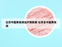 北京中医黄尧洲治疗银屑病 北京名中医黄尧洲