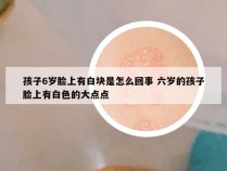 孩子6岁脸上有白块是怎么回事 六岁的孩子脸上有白色的大点点