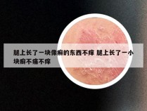 腿上长了一块像癣的东西不痒 腿上长了一小块癣不痛不痒