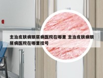 主治皮肤病银屑病医院在哪里 主治皮肤病银屑病医院在哪里挂号