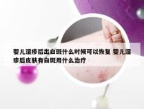 婴儿湿疹后出白斑什么时候可以恢复 婴儿湿疹后皮肤有白斑用什么治疗