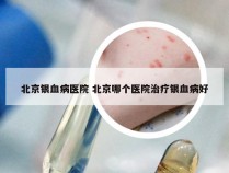 北京银血病医院 北京哪个医院治疗银血病好