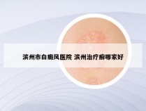 滨州市白癜风医院 滨州治疗癣哪家好