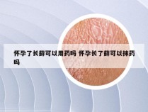 怀孕了长藓可以用药吗 怀孕长了藓可以抹药吗